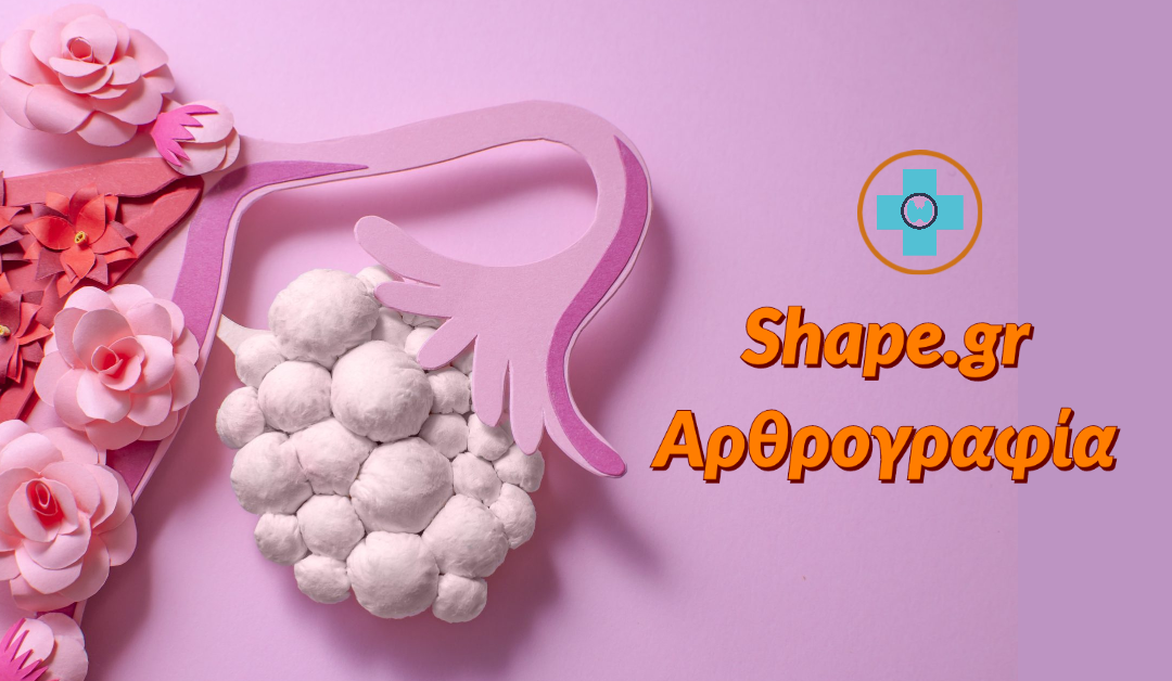 Σύνδρομο πολυκυστικών ωοθηκών: Τα συμπτώματα & η πρώτη θεραπευτική επιλογή των γιατρών