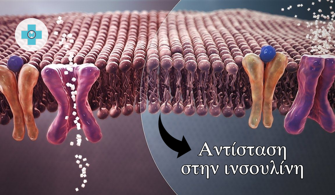 Αντίσταση στην ινσουλίνη – Όσα πρέπει να γνωρίζετε!