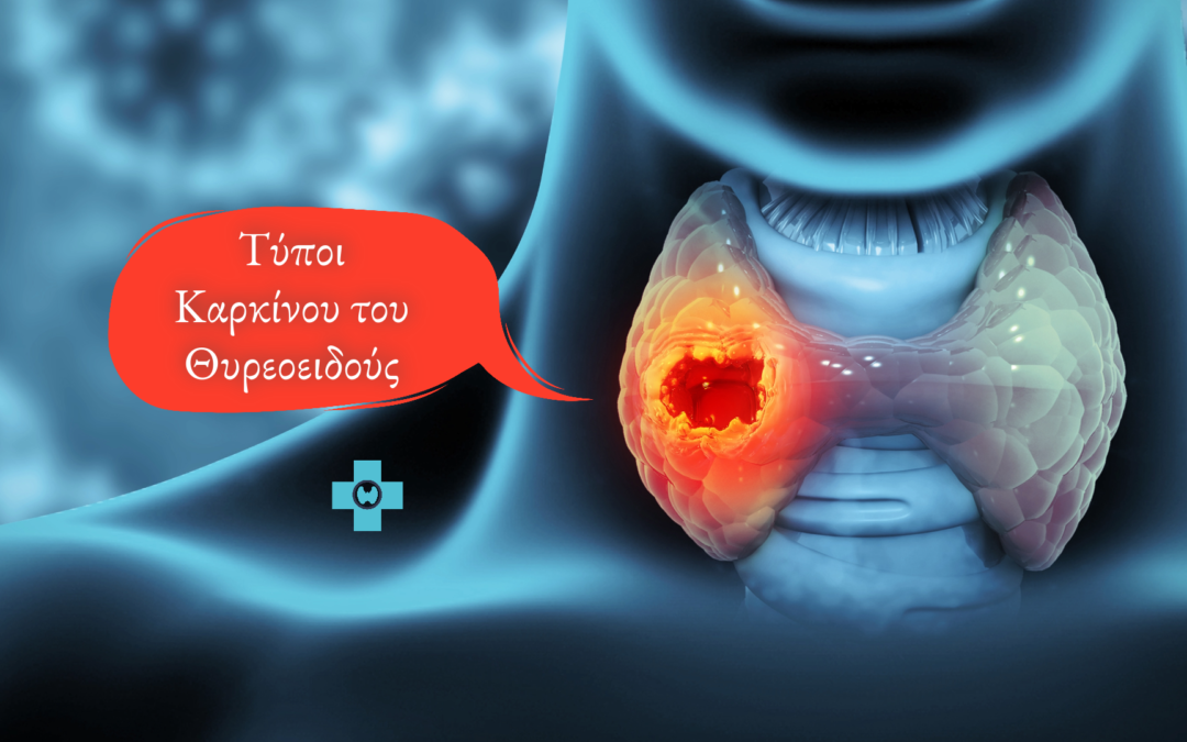 Τύποι Καρκίνου του Θυρεοειδούς