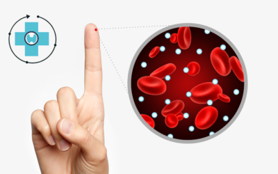 Ινσουλινοαντίσταση