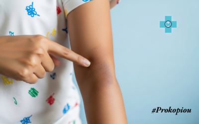 Διαβήτης και Δέρμα – Όσα πρέπει να γνωρίζει κάθε ασθενής